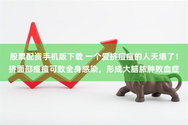 股票配资手机版下载 一个爱挤痘痘的人天塌了！挤面部痘痘可致全身感染，形成大脑脓肿败血症